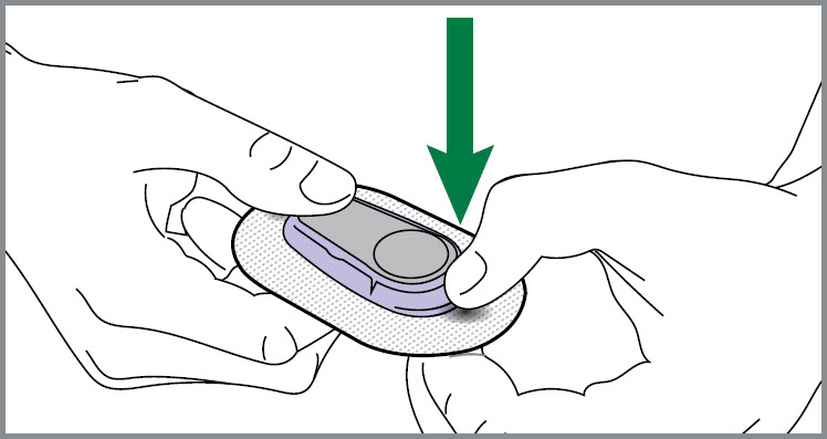 How to release Dexcom transmitter